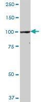 Anti-CPSF2 Mouse Polyclonal Antibody