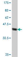 Anti-CORO1A Mouse Polyclonal Antibody