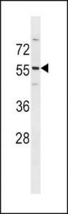 Anti-PDK2 Rabbit Polyclonal Antibody