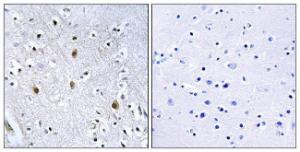 Immunohistochemical analysis of paraffin-embedded human brain tissue using Anti-IRS-1 Antibody. The right hand panel represents a negative control, where the antibody was pre-incubated with the immunising peptide