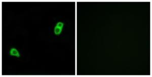 Immunofluorescence analysis of LOVO cells using Anti-GPR34 Antibody. The right hand panel represents a negative control, where the antibody was pre-incubated with the immunising peptide