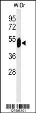 Anti-PSTPIP1 Rabbit Polyclonal Antibody