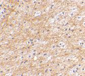 Anti-AIFM3 Rabbit Polyclonal Antibody