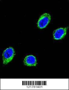 Anti-CCHCR1 Rabbit Polyclonal Antibody (APC (Allophycocyanin))