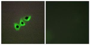 Immunofluorescence analysis of A549 cells using Anti-RHG07 Antibody. The right hand panel represents a negative control, where the Antibody was pre-incubated with the immunising peptide