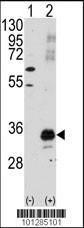 Anti-PIM1 Rabbit Polyclonal Antibody