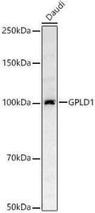 Western blot analysis of Daudi, using Anti-GPI-PLD Antibody (A305497) at 1:500 dilution