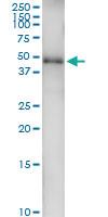 Anti-GATA1 Polyclonal Antibody Pair