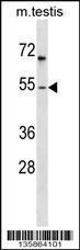 Anti-FOXF1 Rabbit Polyclonal Antibody (FITC (Fluorescein Isothiocyanate))