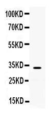 Anti-TREX1 Rabbit Polyclonal Antibody