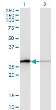 Anti-TCEAL1 Mouse Monoclonal Antibody [clone: 3B9]