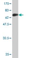 Anti-C5AR1 Mouse Monoclonal Antibody [clone: 4E2]