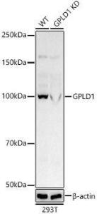 Western blot analysis of extracts from wild type(WT) and GPLD1 Rabbit polyclonal antibody knockdown (KD) 293T cells, using Anti-GPI-PLD Antibody (A305497) at 1:500 dilution