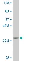 Anti-WT1 Mouse Monoclonal Antibody [clone: 1E9]