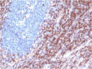 Immunohistochemical analysis of formalin-fixed, paraffin-embedded human tonsil using Anti-Bcl-2 Antibody [rBCL2/6418]