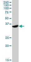 Anti-IFNGR2 Rabbit Polyclonal Antibody