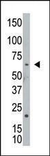 Anti-NEK8 Rabbit Polyclonal Antibody (HRP (Horseradish Peroxidase))