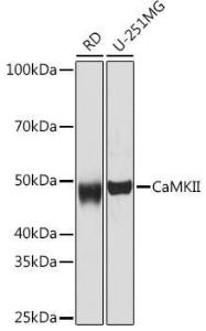 Western blot analysis of extracts of various cell lines, using Anti-CaMKII beta Antibody [ARC1813] (A305498) at 1:1,000 dilution. The secondary antibody was Goat Anti-Rabbit IgG H&L Antibody (HRP) at 1:10,000 dilution.