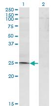 Anti-TGIF2 Mouse Monoclonal Antibody [clone: 2A4]