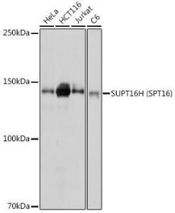 Anti-SUPT16H Rabbit Polyclonal Antibody