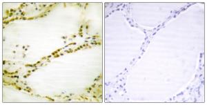 Immunohistochemical analysis of paraffin-embedded human thyroid gland tissue using Anti-RGS16 Antibody. The right hand panel represents a negative control, where the antibody was pre-incubated with the immunising peptide.