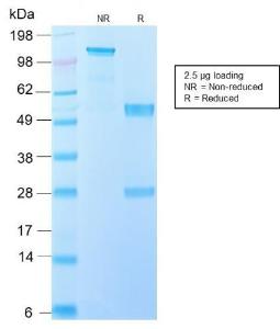 SDS-PAGE analysis of Anti-IL-10 Antibody [IL10/2651R] under non-reduced and reduced conditions; showing intact IgG and intact heavy and light chains, respectively. SDS-PAGE analysis confirms the integrity and purity of the antibody.