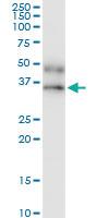 Anti-IFNGR2 Rabbit Polyclonal Antibody