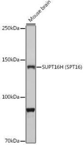 Anti-SUPT16H Rabbit Polyclonal Antibody