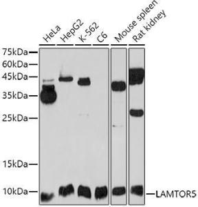 Western blot analysis of extracts of various cell lines, using Anti-HBXIP Antibody (A11544) at 1:1,000 dilution The secondary antibody was Goat Anti-Rabbit IgG H&L Antibody (HRP) at 1:10,000 dilution Lysates/proteins were present at 25 µg per lane