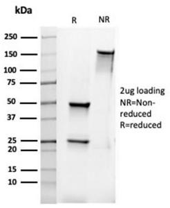 SDS-PAGE analysis of Anti-Bcl-2 Antibody [rBCL2/6418] under non-reduced and reduced conditions; showing intact IgG and intact heavy and light chains, respectively. SDS-PAGE analysis confirms the integrity and purity of the antibody