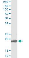 Anti-TCEAL1 Mouse Monoclonal Antibody [clone: 3B9]