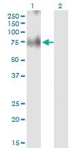 Anti-SLC30A5 Mouse Monoclonal Antibody [clone: 2E10]