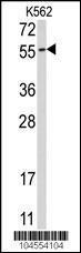 Anti-UBQLN1 Rabbit Polyclonal Antibody (AP (Alkaline Phosphatase))