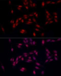 Anti-SUPT16H Rabbit Polyclonal Antibody