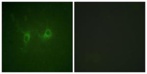 Immunofluorescence analysis of COS7 cells using Anti-RGS16 Antibody. The right hand panel represents a negative control, where the antibody was pre-incubated with the immunising peptide.