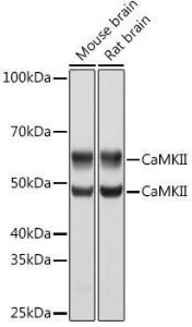 Western blot analysis of extracts of various cell lines, using Anti-CaMKII beta Antibody [ARC1813] (A305498) at 1:1,000 dilution. The secondary antibody was Goat Anti-Rabbit IgG H&L Antibody (HRP) at 1:10,000 dilution.