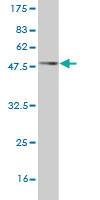 Anti-CXCL16 Mouse Monoclonal Antibody [clone: 2B12]