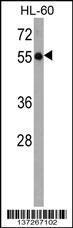 Anti-KLHL3 Rabbit Polyclonal Antibody (HRP (Horseradish Peroxidase))