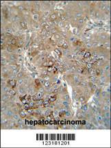 Anti-CES1P1 Rabbit Polyclonal Antibody (Biotin)