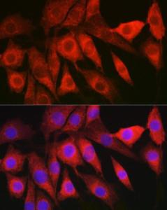 Immunofluorescence analysis of NIH/3T3 cells using Anti-HBXIP Antibody (A11544) at a dilution of 1:200 (40x lens) DAPI was used to stain the cell nuclei (blue)