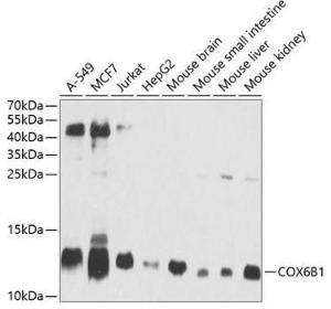 Antibody anti-COX6B1 100 µl