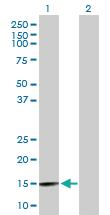 Anti-BRWD1 Mouse Polyclonal Antibody