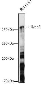 Western blot analysis of extracts of Rat brain, using Anti-Hivep3 Antibody (A306384) at 1:1,000 dilution. The secondary antibody was Goat Anti-Rabbit IgG H&L Antibody (HRP) at 1:10,000 dilution.