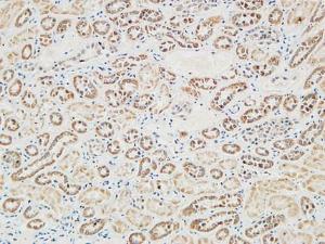 Immunohistochemical analysis of paraffin-embedded human Right kidney using Anti-RGS16 Antibody