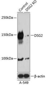 Anti-Desmoglein 2/DSG2 Rabbit Polyclonal Antibody