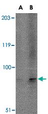 Anti-TMC6 Rabbit Polyclonal Antibody