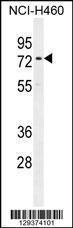 Anti-CCDC63 Rabbit Polyclonal Antibody