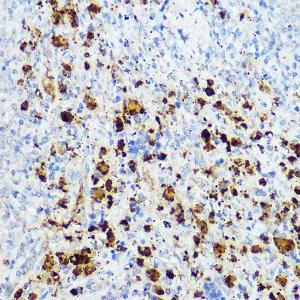 Immunohistochemistry analysis of paraffin-embedded mouse spleen using Anti-Hivep3 Antibody (A306384) at a dilution of 1:50 (40x lens). Perform high pressure antigen retrieval with 10 mM citrate buffer pH 6.0 before commencing with IHC staining protocol.