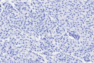 Anti-CCKBR Goat Polyclonal Antibody