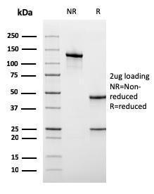 SDS-PAGE analysis of Anti-CD45RA Antibody [rPTPRC/1131] under non-reduced and reduced conditions; showing intact IgG and intact heavy and light chains, respectively. SDS-PAGE analysis confirms the integrity and purity of the antibody.